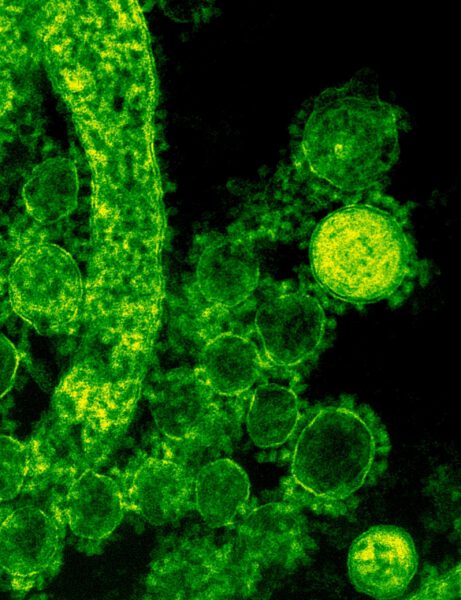 First human case of EEE in the state found in Worcester County